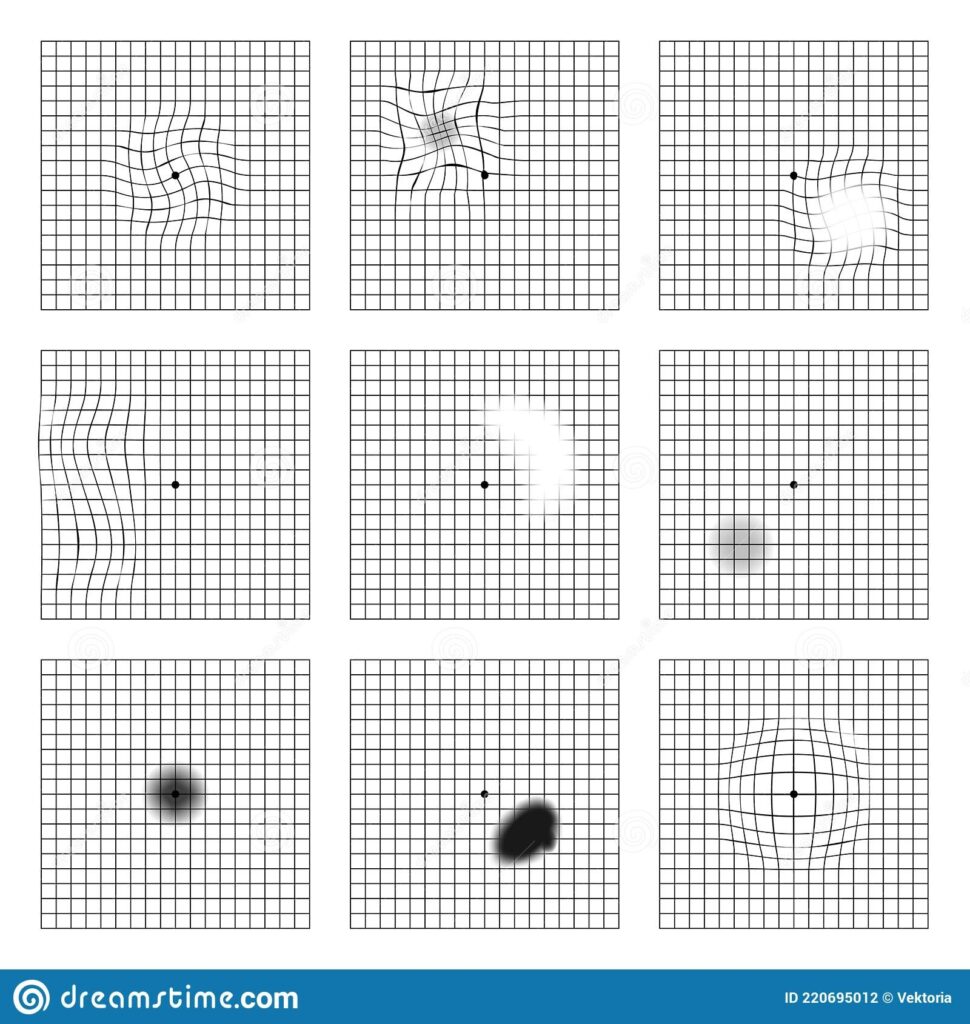 Eye Chart Printable For Macular Degeneration