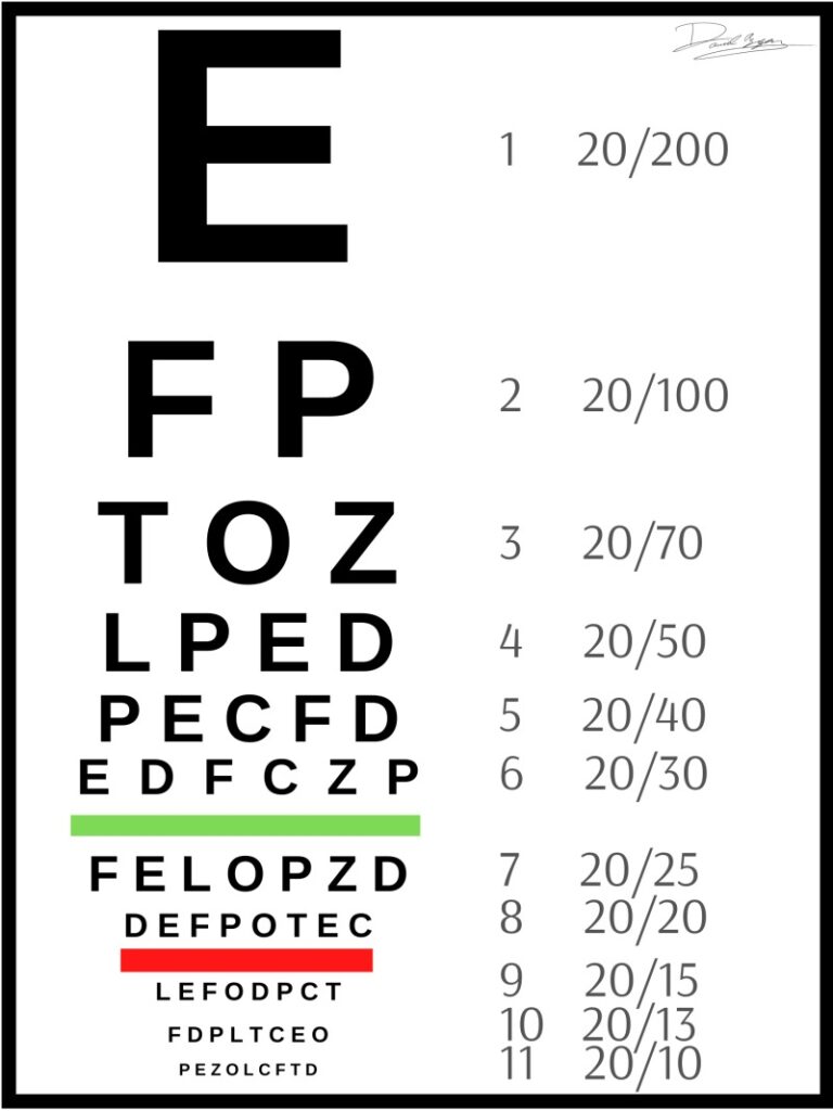 Figure A Snellen Eye Chart For Visual Acuity Testing Contributed By Daniel Azzam StatPearls NCBI Bookshelf