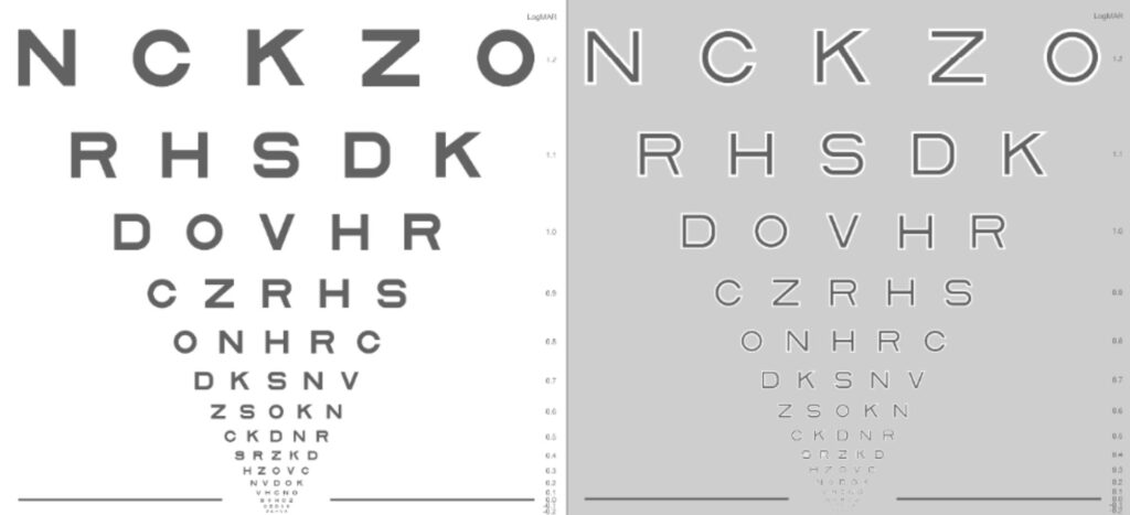 Moorfields Acuity Chart Novel Sight Test Detects Early Age Related Macular Degeneration Sci News