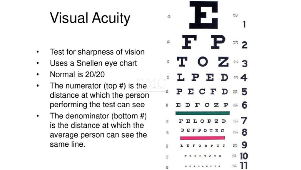 Snellen Eye Chart Manufacturer SHANGHAI MEDICAL